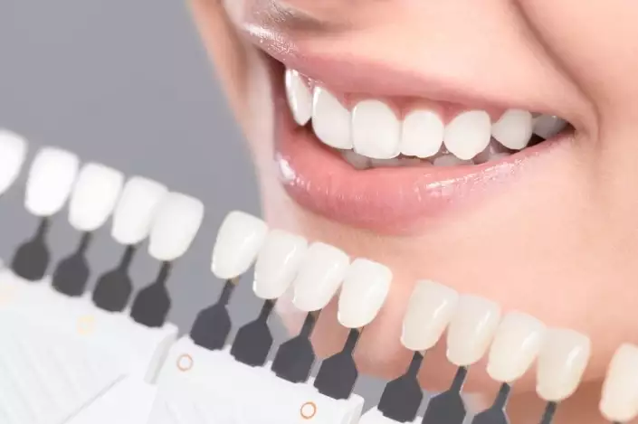 ▷ Цены на эстетическую стоматологию 2022 | Как это делается?
